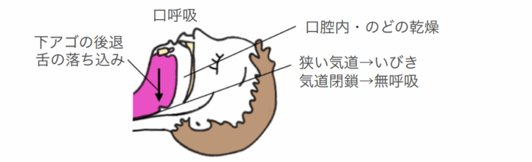 7. 子どもの睡眠と歯並び ― いびきや無呼吸のサインに注目