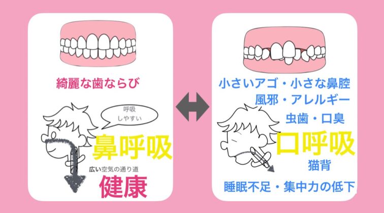 4. 鼻呼吸できる子を育てよう！口呼吸のサインを見逃さないで